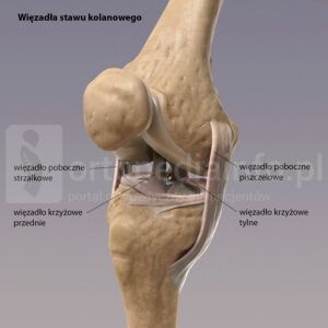 uszkodzenie więzadła krzyżowego przedniego - więzadła w stawie kolanowym